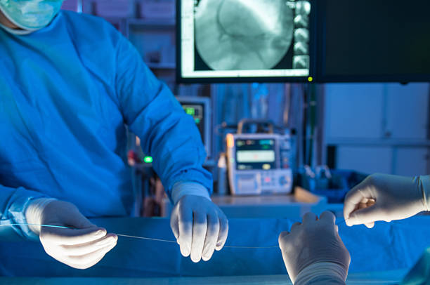 endoprótesis cardíaca de la cirugía - procedimiento médico fotografías e imágenes de stock