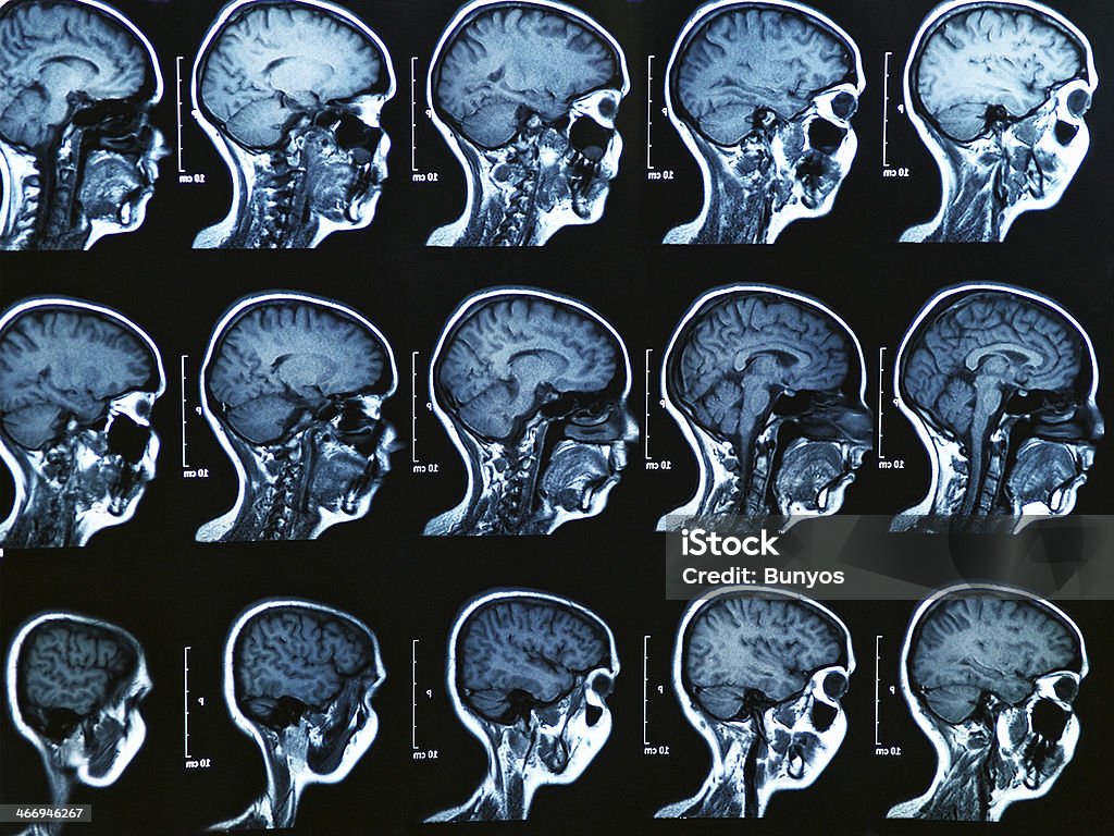 MRI Brain Scan MRI scan of the human brain MRI Scanner Stock Photo