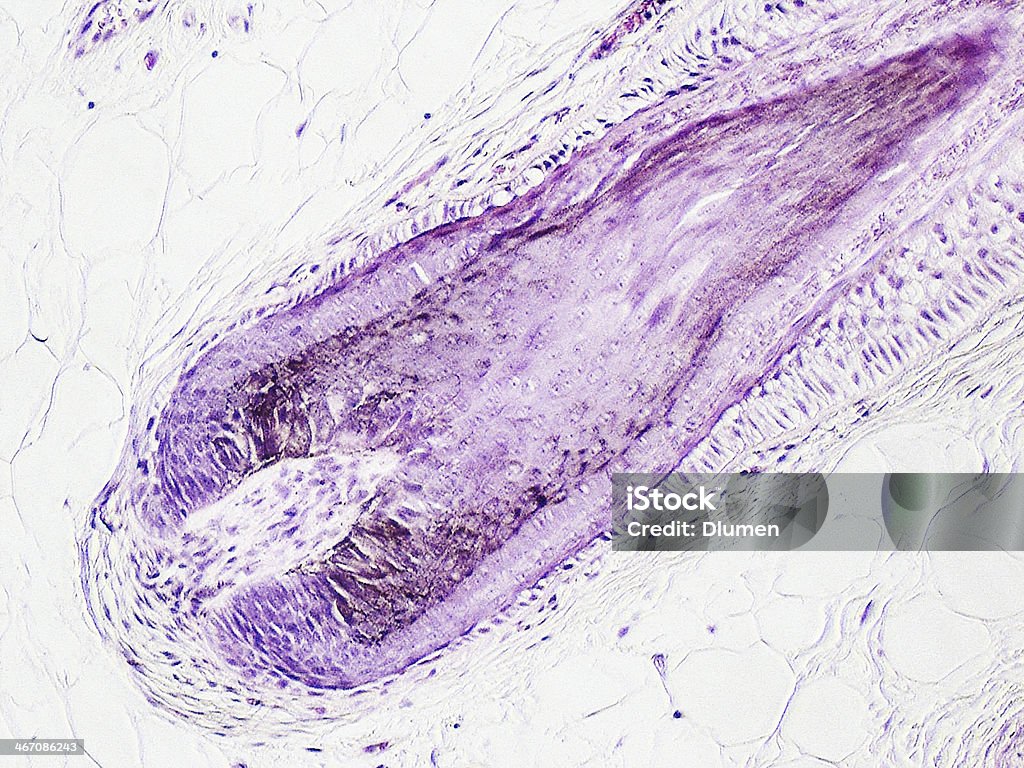 Folicle de cabello - Foto de stock de Efecto de multi capa libre de derechos