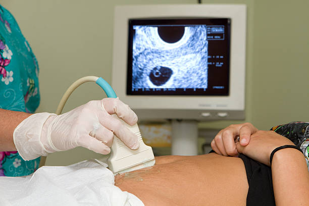 Pregnancy Ultrasound stock photo