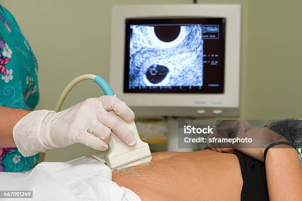 Pregnancy Ultrasound Stock Photo - Download Image Now - Sonographer, Abdomen, Nurse