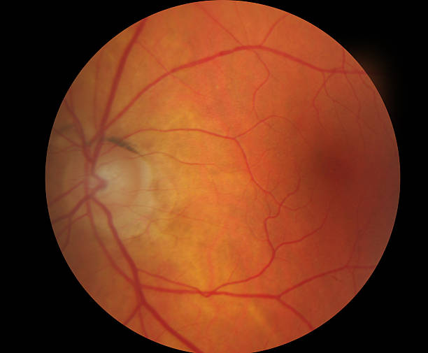 istock Medical fundus photo of macula 467107436