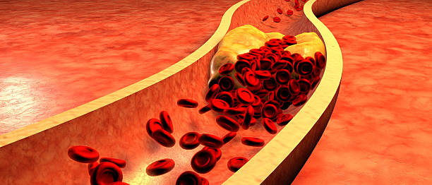 Illustration of a clogged artery with platelets and plaque Clogged Artery with platelets and cholesterol plaque, concept for health risk for obesity or dieting and nutrition problems coronary artery photos stock pictures, royalty-free photos & images