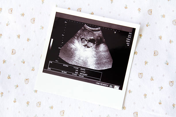 Ultrasound image for pregnancy Photo of an ultrasound sonogram of an unborn baby human embryo photos stock pictures, royalty-free photos & images
