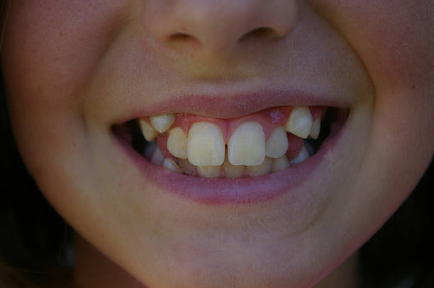 若い女性の歯のクローズアップ - child smiling human teeth dental hygiene ストックフォトと画像