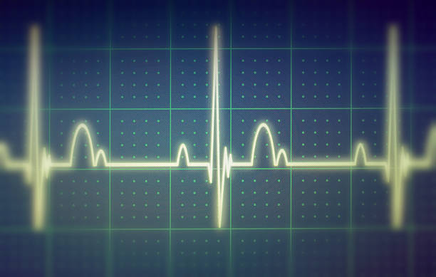 istock ECG / EKG monitor 467306290