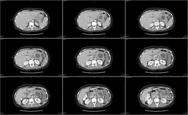 tomografia komputerowa trzustka - stomach the human body abdomen human digestive system zdjęcia i obrazy z banku zdjęć