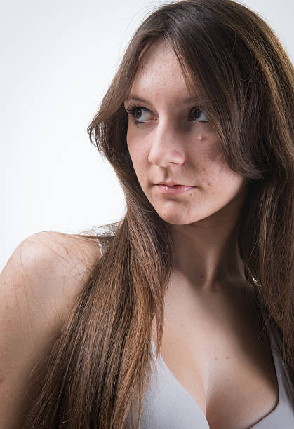 mädchen mit pimples - fashion model women cleavage human hair stock-fotos und bilder
