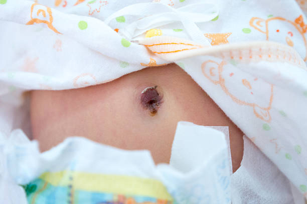 istock Newborn baby umbilicus close-up. 467653426