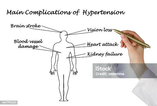 Complicanze Principali Dellipertensione - Fotografie stock e altre immagini di Adulto - Adulto, Aggressione, Cervello umano