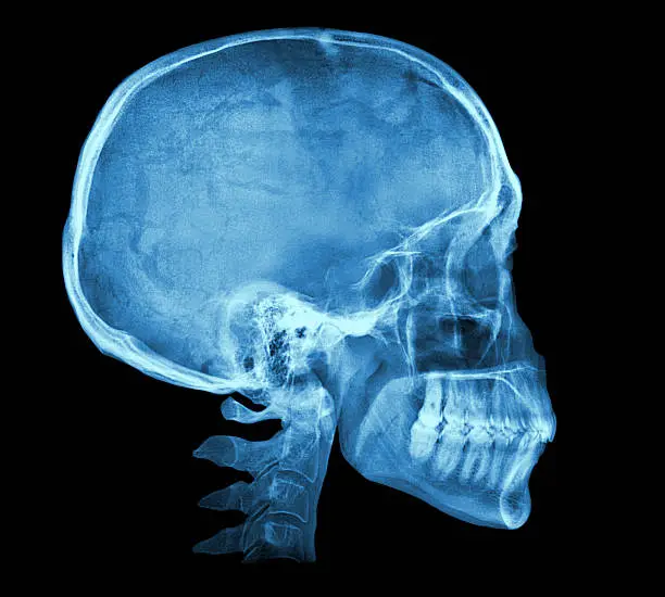Human skull X-ray image isolated on black