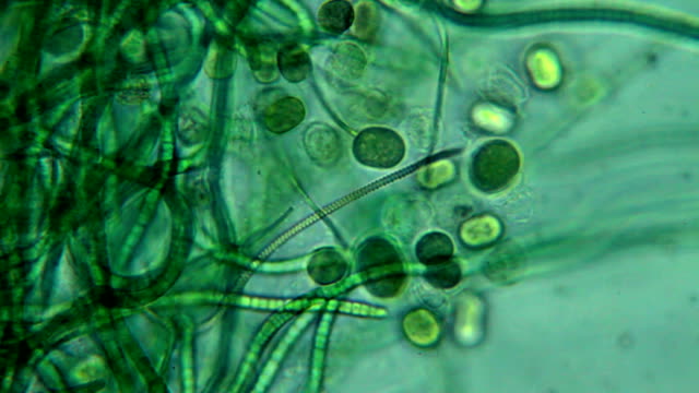 Algae - microscopic view