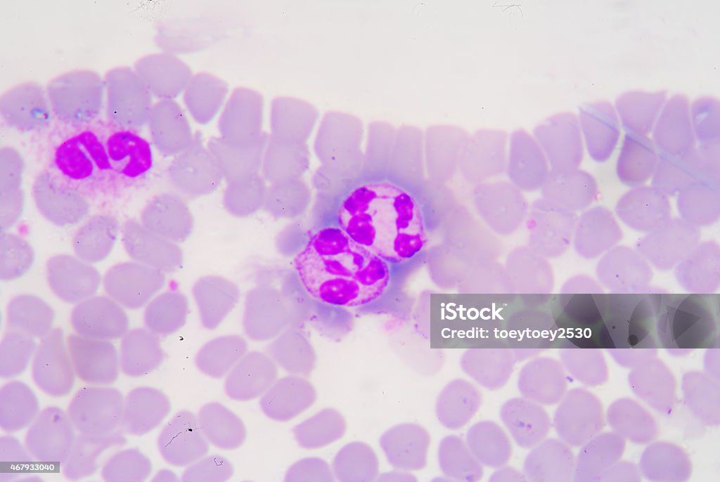 White blood cells of a human, White blood cells of a human, photomicrograph panorama as seen under the microscope, 1000x zoom. Chronic Granulocytic Leukemia Stock Photo