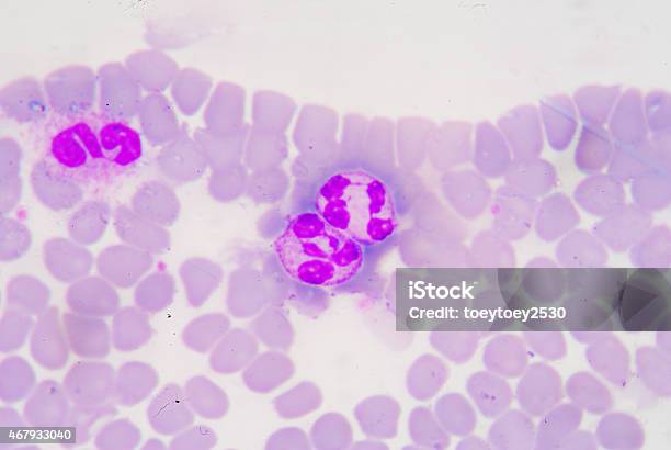 White Blood Cells Of A Human Stock Photo - Download Image Now - Chronic Granulocytic Leukemia, Histology, Leukemia