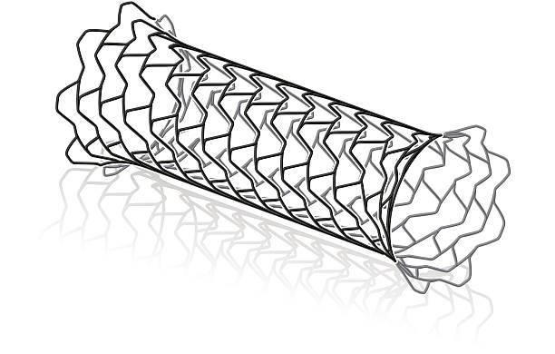 Metal stent on white background vector art illustration