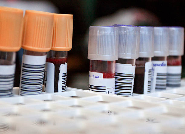 le provette di sangue in laboratorio - aciculum foto e immagini stock