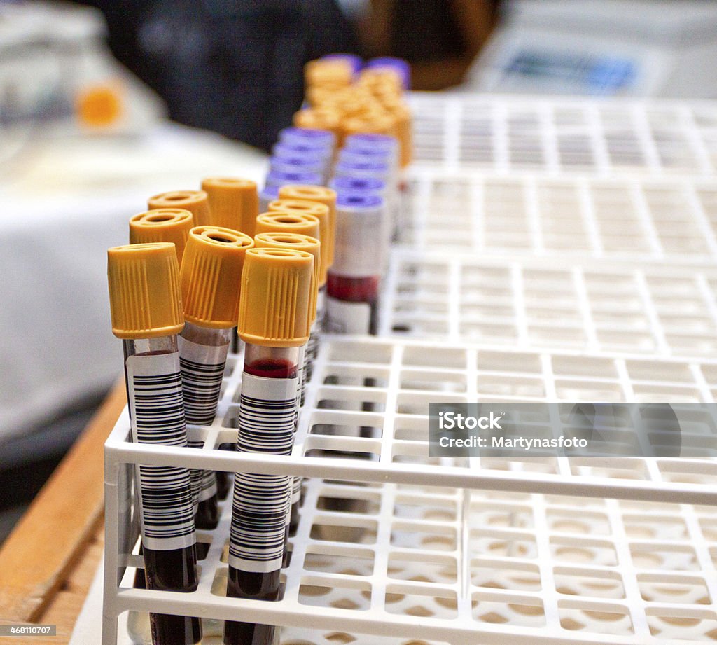 Blood tubes in the holder Test tubes in the holder in the laboratory Red Stock Photo