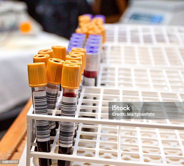 Blood Tubes In The Holder Stock Photo - Download Image Now - Red, Urine, Acid