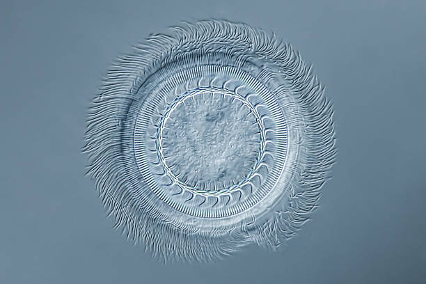 aboral ciliary wreath - 80µm - differential interference contrast