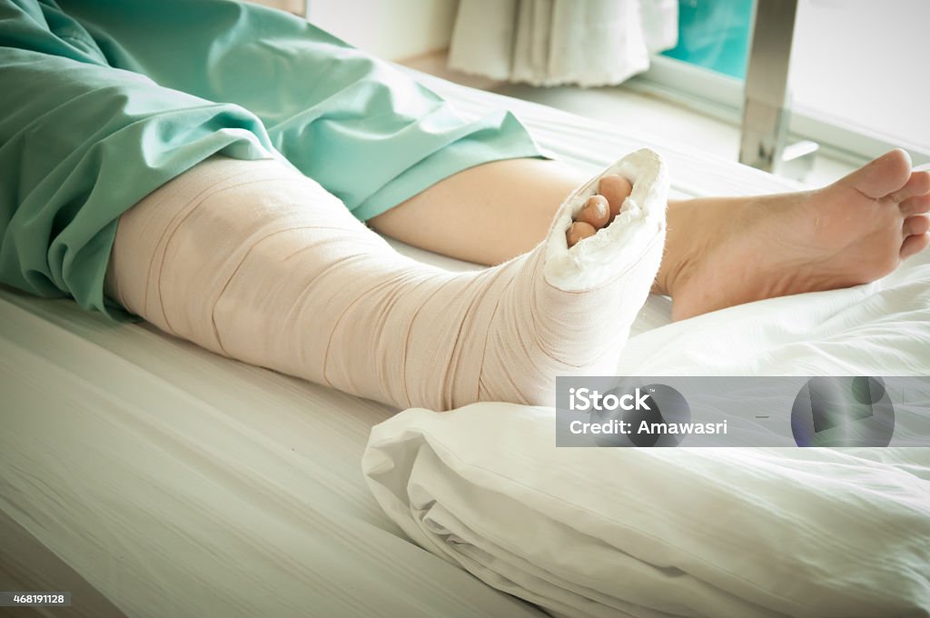 Broken Leg 2015 Stock Photo