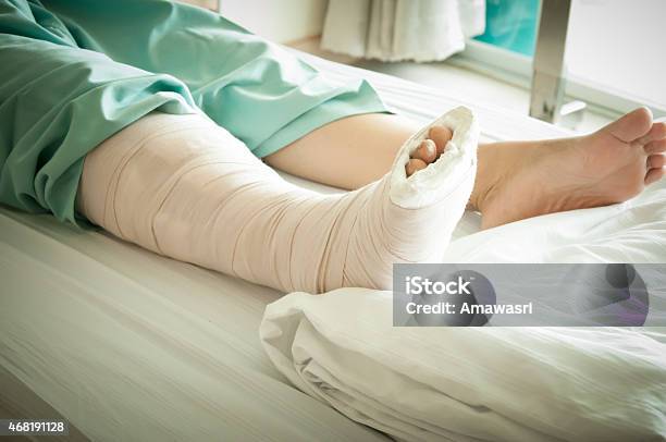 Broken Leg Stock Photo - Download Image Now - 2015, Bandage, Bone Fracture