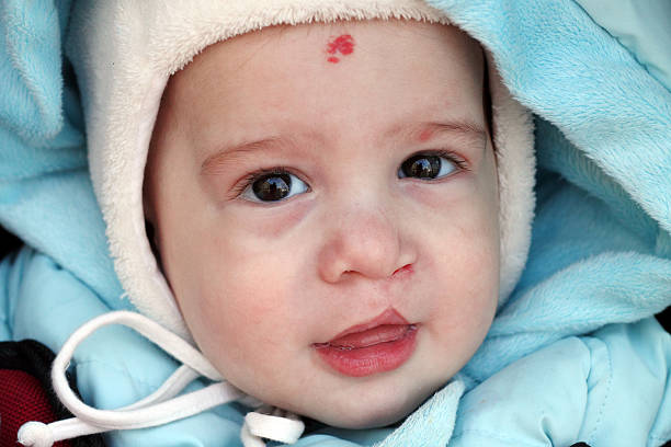 Smiling baby Baby withlip cleft in winter cleft lip stock pictures, royalty-free photos & images