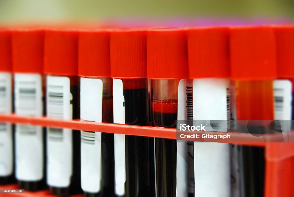 Blood samples in blood bank Blood samples donated for blood bank. Blood Group Stock Photo