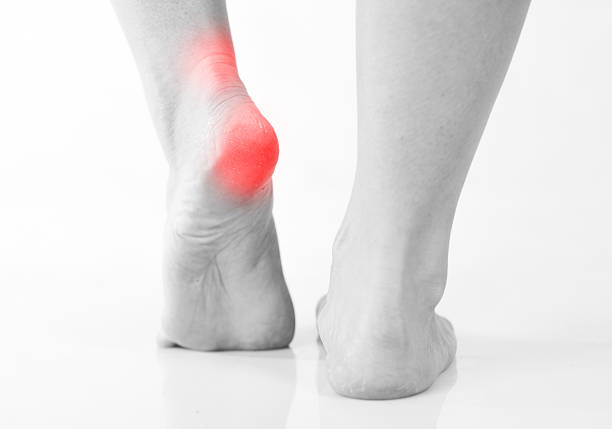 istock Woman's legs, heel and ankle pain 468837036