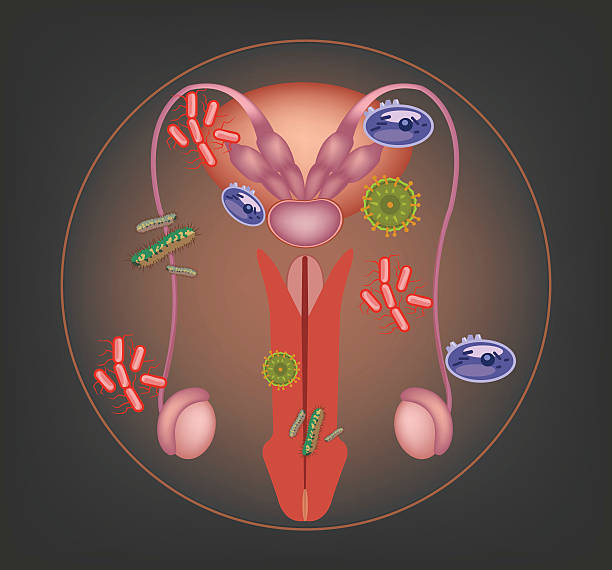мужской заболеваний репродуктивной системы. векторная иллюстрация - головка пениса иллюстрации stock illustrations