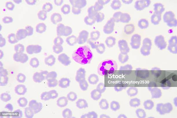 White Blood Cells Of A Human Stock Photo - Download Image Now - Chronic Granulocytic Leukemia, 2015, Bacterium