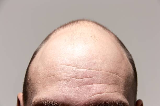 istock Close-up of a man 468979620