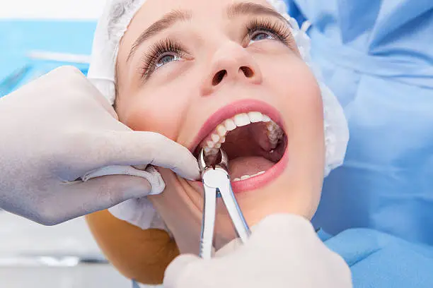 Young woman having tooth removed. Close up picture of a woman mouth with a dentist hand holding extraction forceps