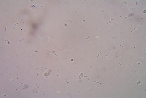 bacteria in urine of a human, photomicrograph panorama as seen under the microscope