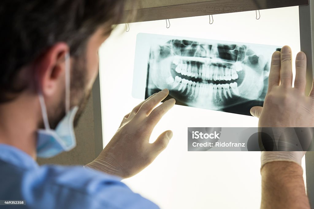 x-ray dentaire - Photo de Imagerie par rayons x libre de droits