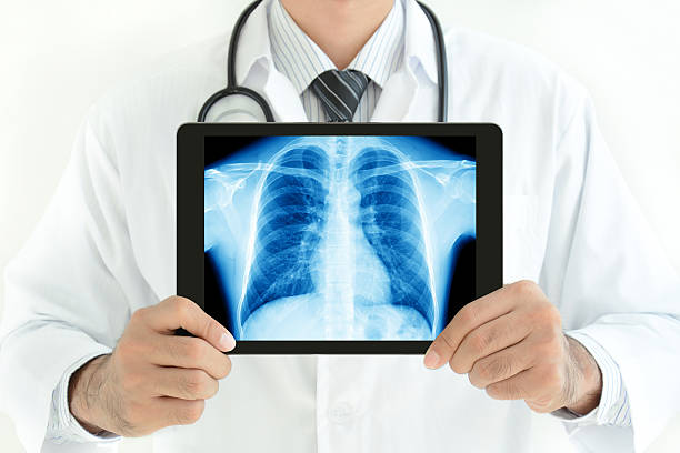 istock Doctor holding tablet pc with normal male chest x-ray image 469447044
