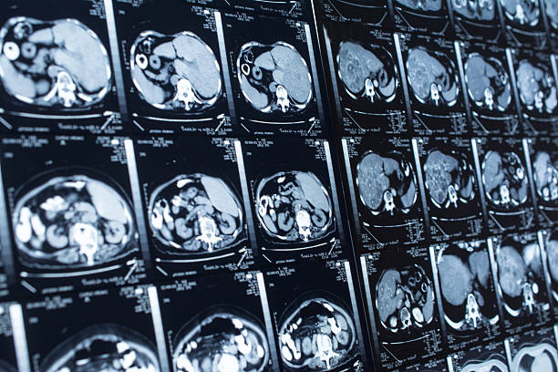 istock research in medicine. CT scan of the patient. 469585142