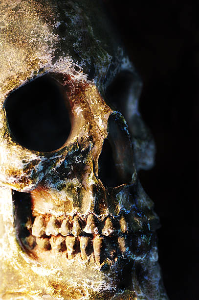 istock Close up of cracked and damaged human skull 469607841
