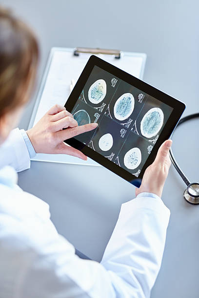 medico femminile analizzando il cervello dei raggi x su tavoletta digitale - doctor brain x ray x ray image foto e immagini stock