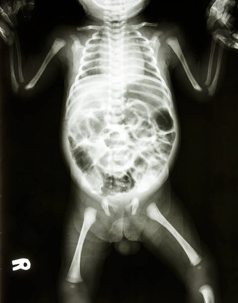 istock normal skeleton of infant 469680673