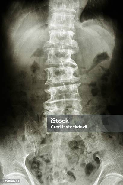 Согнутый В Поясничном Отделе Позвоночника И Зубцы Старый Человек — стоковые фотографии и другие картинки Анатомия