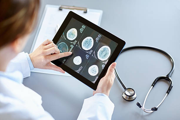 medico, analisi dei raggi x del cervello, toccare su digital tablet - doctor brain x ray x ray image foto e immagini stock