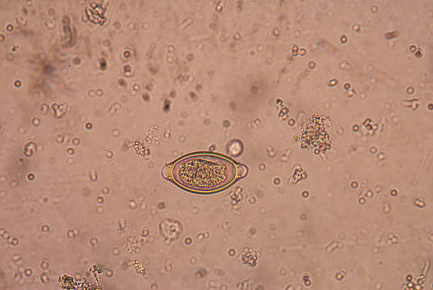 230+ Fotos, Bilder und lizenzfreie Bilder zu Schistosomiasis Fotos iStock