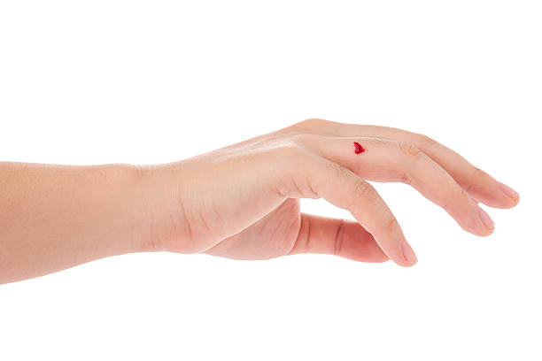istock wounded finger with blood dripping isolated on white. 469753606