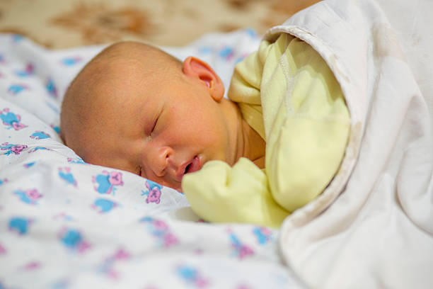 Jaundice in a newborn baby stock photo