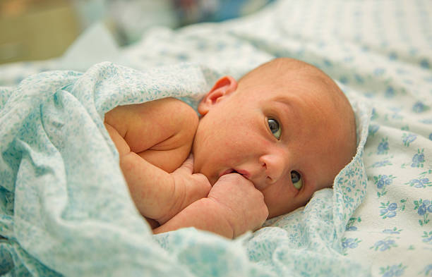 Skin rashes from overheating in the newborn stock photo