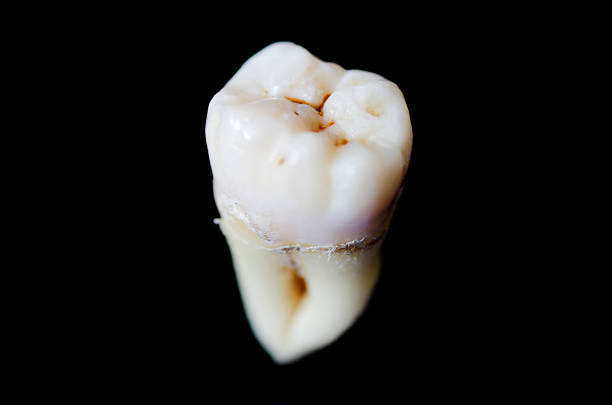 Wisdom Real human wisdom tooth over black background cusp stock pictures, royalty-free photos & images
