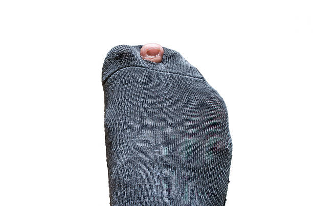 istock worn out sock with a hole and toes sticking out 469926336