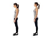 istock Woman with impaired posture position defect scoliosis and ideal bearing 469966818