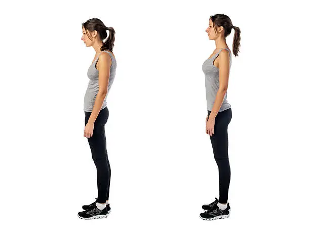 Woman with impaired posture position defect scoliosis and ideal bearing.