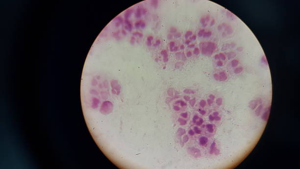 istock Nisseria Meningitidis 470006303